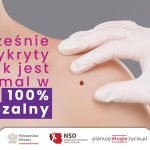 Badanie skóry. Dłoń w rękawiczce położona na ramieniu obok pieprzyka.