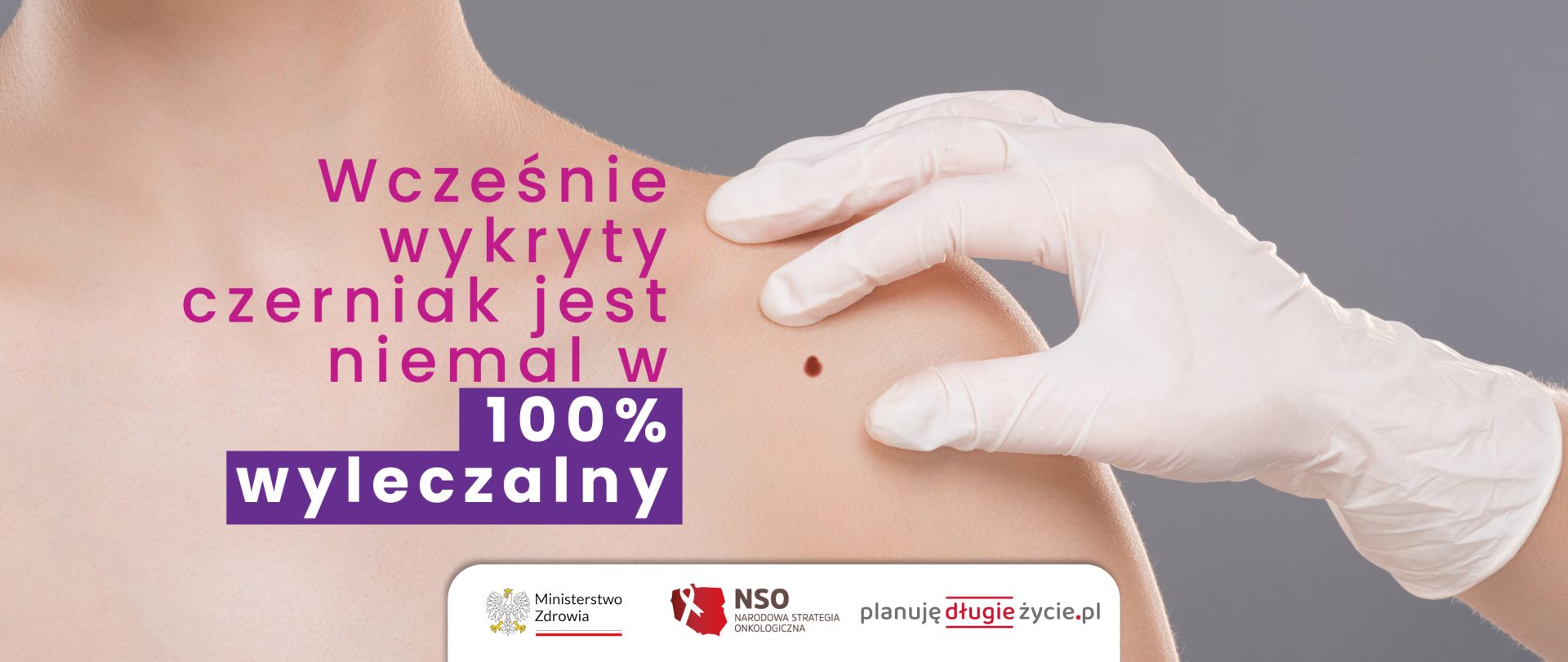 Badanie skóry. Dłoń w rękawiczce położona na ramieniu obok pieprzyka.